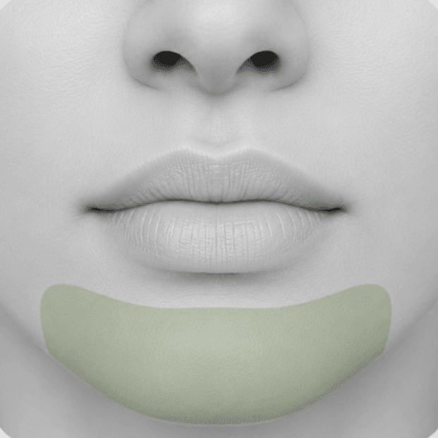 Chin at NYLaser-Wax. More than Hair Removal. It’s Skin Renewal in Yonkers, NY