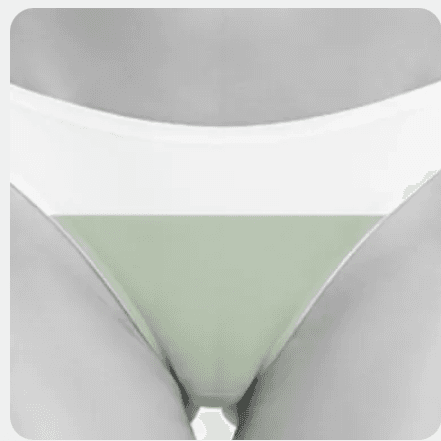 Bikini Line at NYLaser-Wax. More than Hair Removal. It’s Skin Renewal in Yonkers, NY