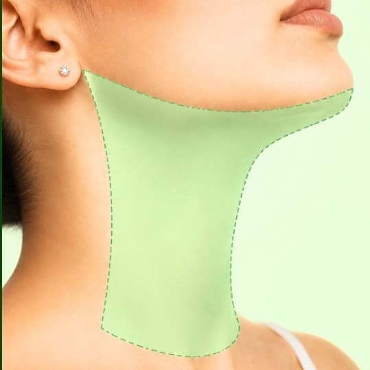 Chin Extension at NYLaser-Wax. More than Hair Removal. It’s Skin Renewal in Yonkers, NY